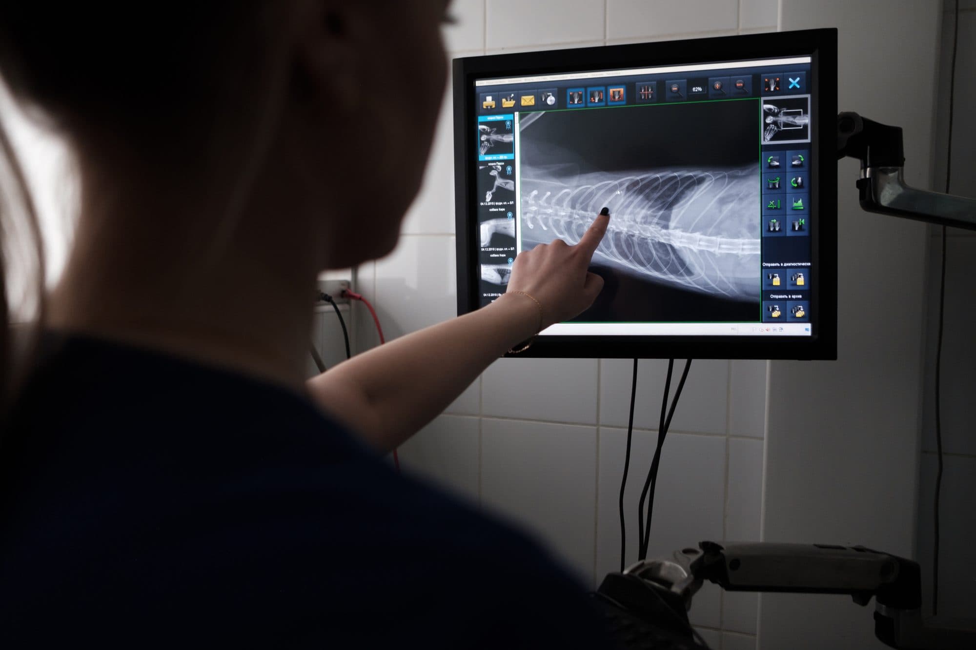 Clinician reviewing a radiograph on a diagnostic display